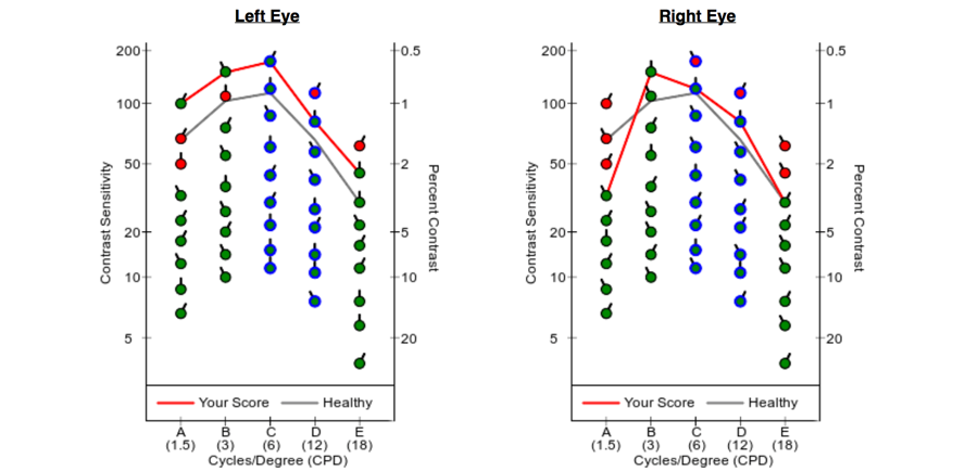 Contrast Sensitivity Chart Pdf